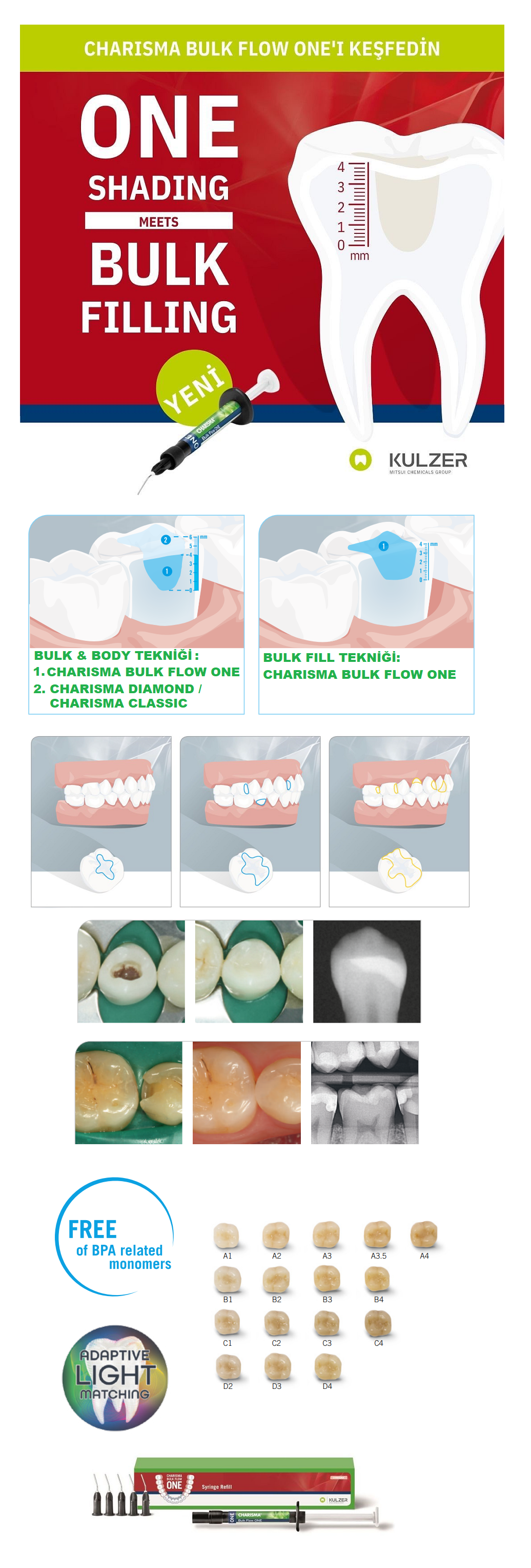 Charisma Bulk Flow One